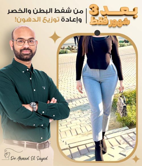 افضل دكتور شفط البطن في مصر